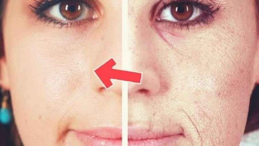 Maska që sfidon dhe Botox-in, si të dukeni 10 vite më e re