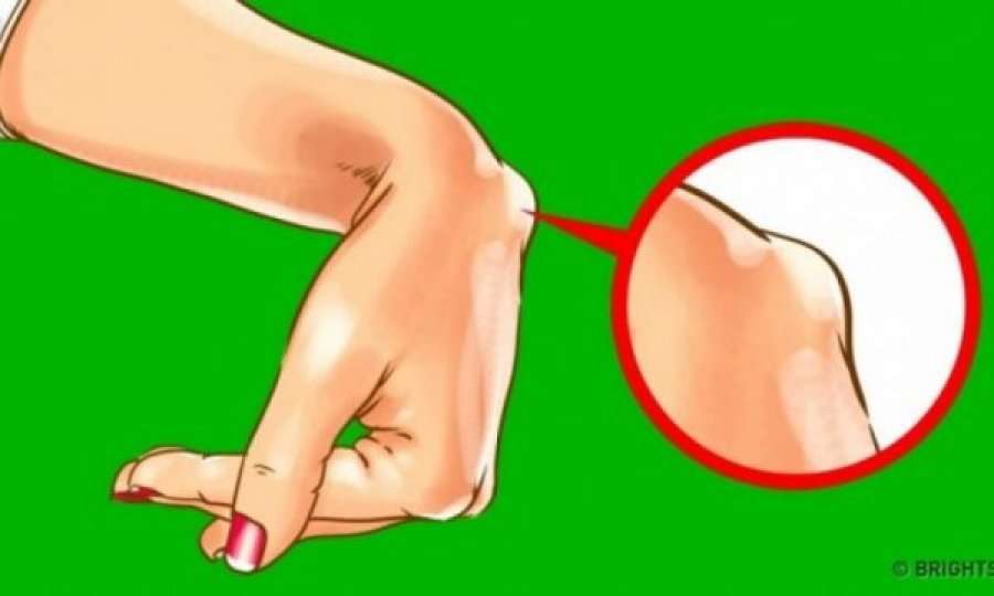 Ju nuk e merrni seriozisht, por nëse ju shfaqet gunga në dorë duhet të shqetësoheni