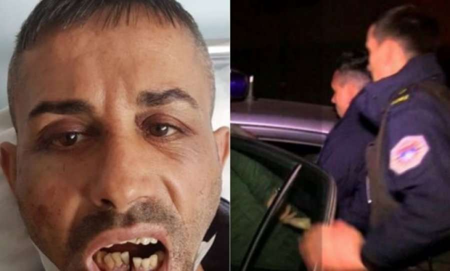Kallëzimi penal ndaj tre policëve dhe tmerri që përjetuan dy qytetarët që festuan fitoren e Vetëvendosjes