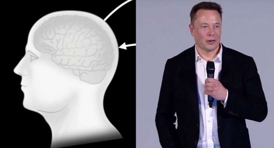 Gjeniu miliarder “Elon Musk” fillon krijimin e “njeriut-kompjuter”