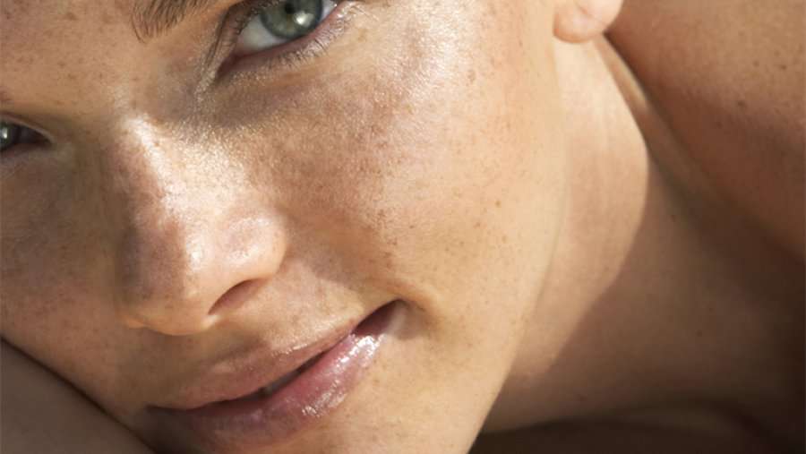 Çka duhet të dini për njollat kafe në lëkurë?