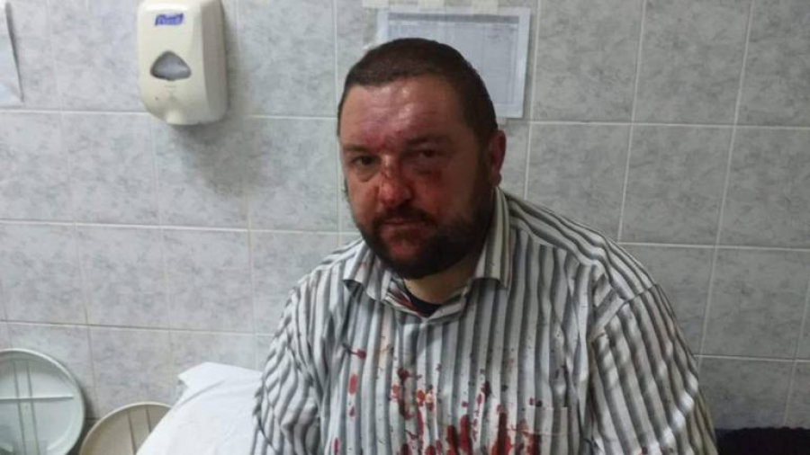 Rrahje mes opozitarëve e pushtetit në Serbi