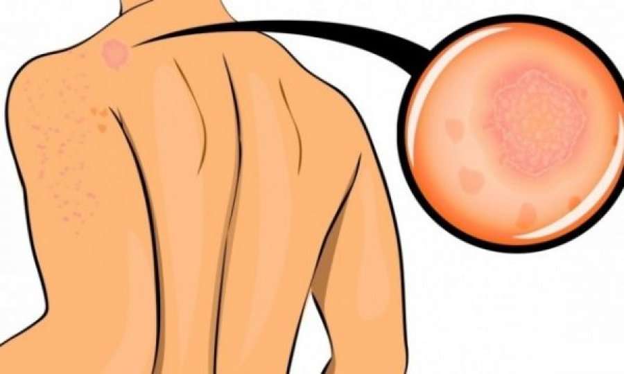 10 shenjat që trupi jua dërgon kur keni tepër stres
