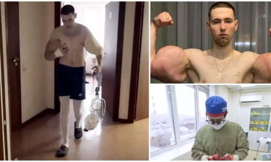 E pabesueshme çka i kanë hequr nga krahët 23-vjeçarit që u bë hi për muskujt e rremë