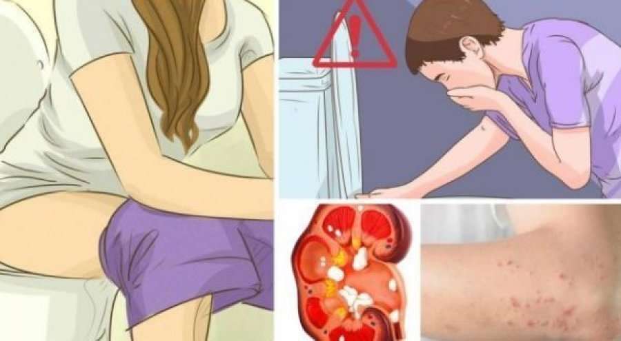 Kjo kurë fantastike në shtëpinë tuaj do ju shpëtojë nga infeksionet e traktit urinar
