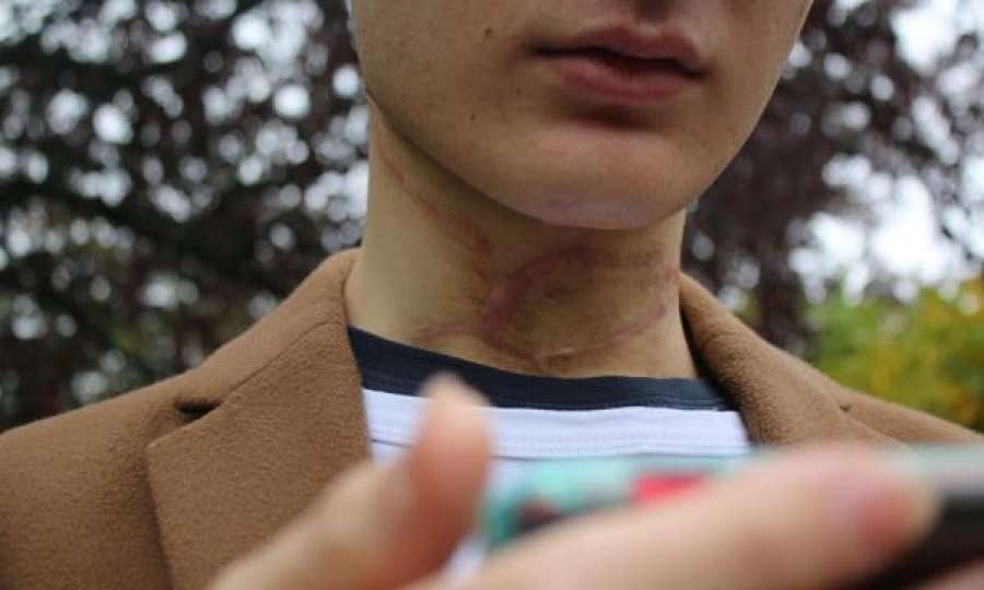 Tmerruese, babai i pret fytin djalit homoseksual