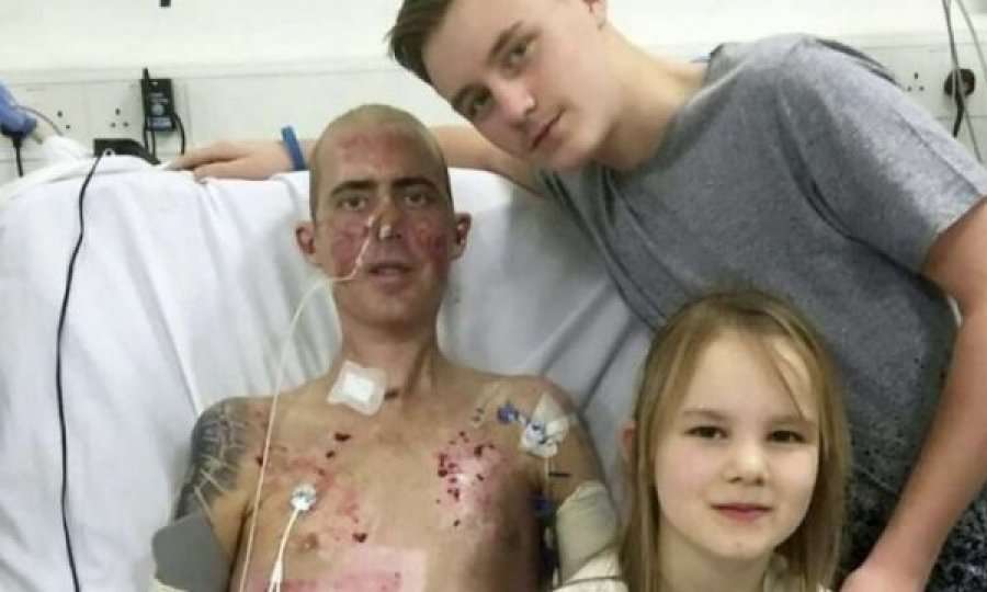 Shkon në spital me grip kthehet me një dorë dhe pa këmbë