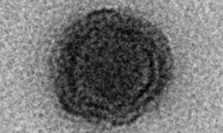 Del një virus misterioz në Brazil