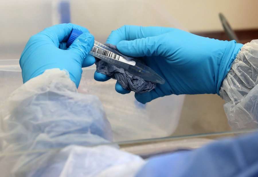 MSH-ja lejon kryerjen e testimeve serologjike për koronavirus në laboratorë privatë