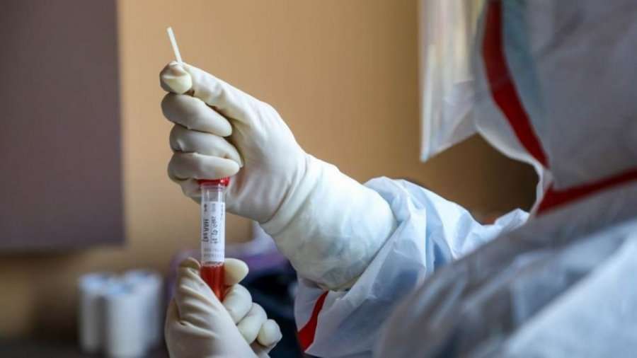 Gënjeu se ka koronavirus, arrestohet nga policia