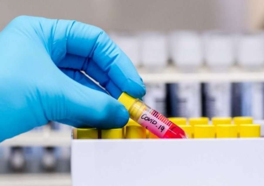 Mbi gjysma e pacientëve me COVID-19 janë infektuar nga persona asimptomatikë