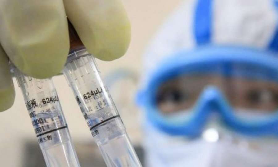 21 raste të reja me COVID-19 në Maqedoninë e Veriut