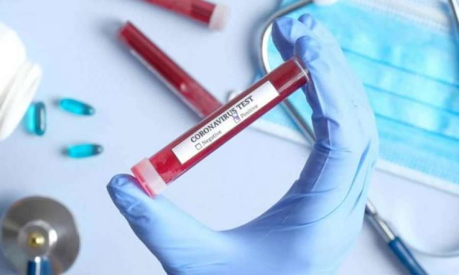 Evropa regjistron 400,000 viktima me koronavirus