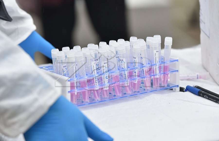 Falsifikohet testi për COVID-19, Prokuroria nis hetimet