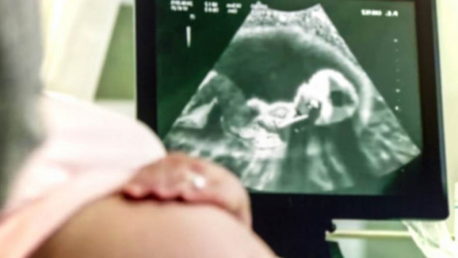 Bebja rreth javës së 28-të hap sytë në bark, xhirim magjepsës me ultrazë [video]