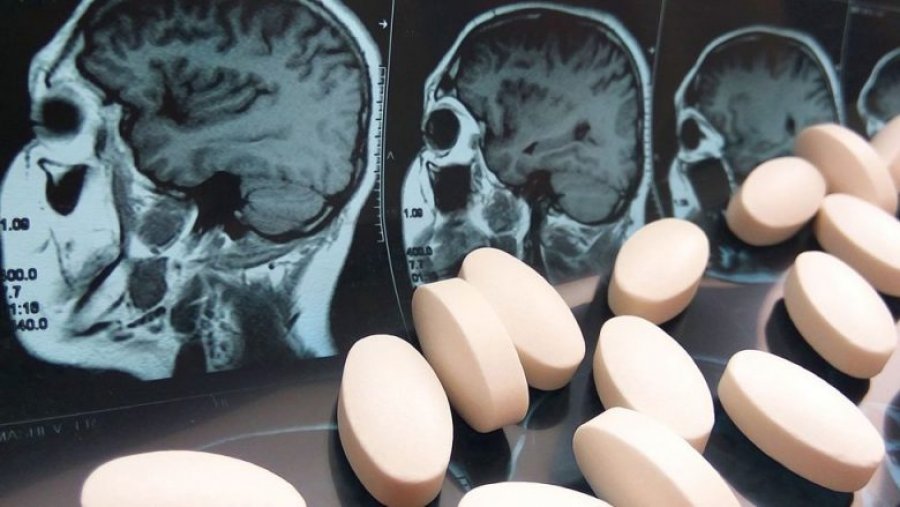 Shkenctarët i paralajmërojnë disa njerëz të mos marrin shpesh paracetamol