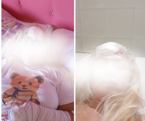 Vajza nga Vushtrria denoncon publikisht babanë e saj: Më goditi me çekan në kokë