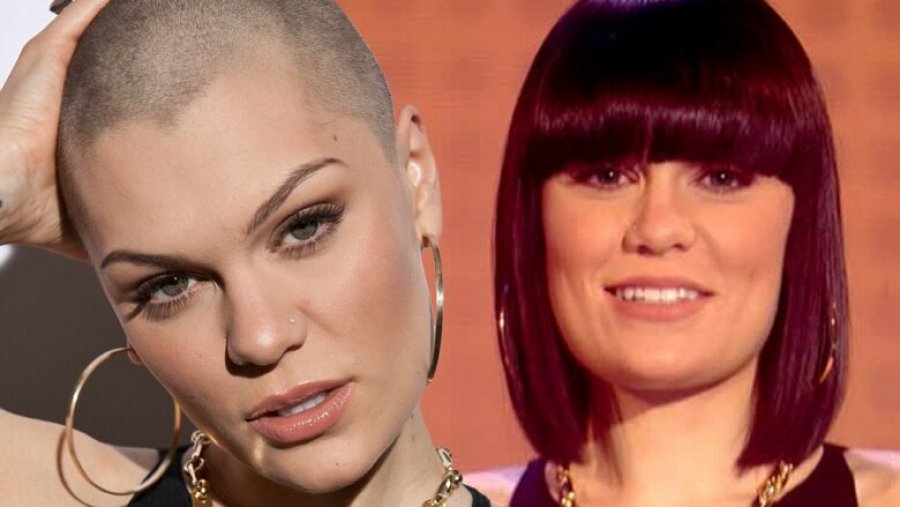 Jessie J flet hapur për gjendjen e saj shëndetësore: Flokët po më bien si të çmendura pas operacionit