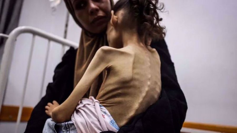 “Amnesty International” akuzon Izraelin se qëllimshëm po shkakton uri në Gazë