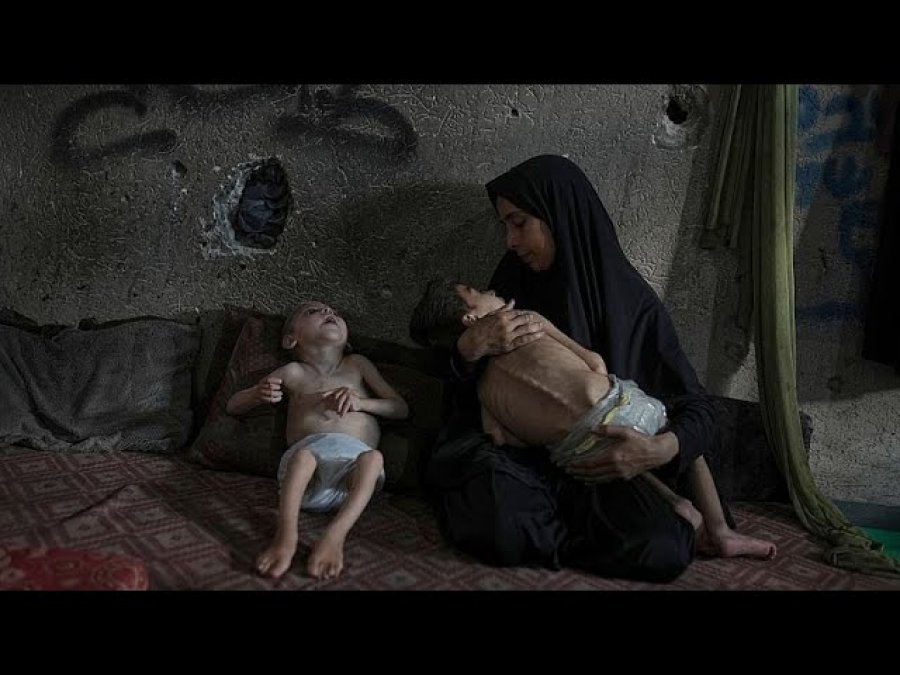 11 palestinezë të tjerë vdesin nga uria në Gazë, numri total arrin në 300
