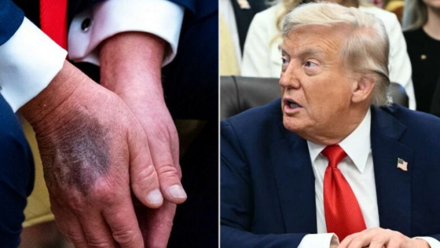 JD Vance tha se është i gatshëm të marrë postin e presidentit, fillojnë thashethemet se Trump ka ndërruar jetë