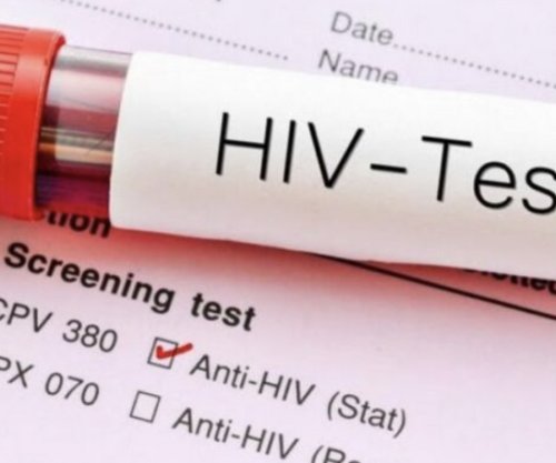 Gjashtë të vdekur këtë vit në Kosovë si pasojë e HIV-AIDS, 31 raste të reja