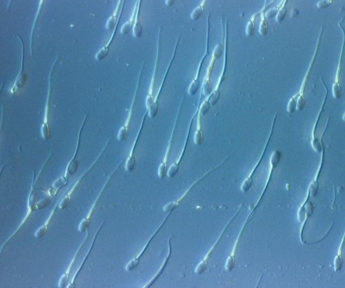 Si u shpërnda në mbarë Europën një gjen kanceri i rrallë?