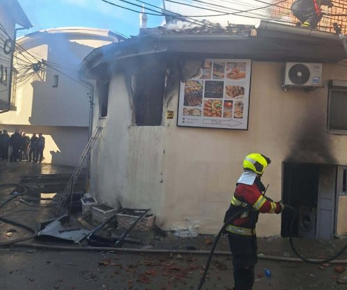 Kjo është gjendja e tre fëmijëve që shpëtuan nga zjarri në Prizren
