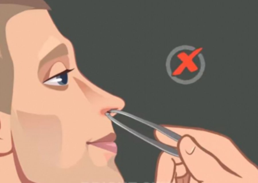 Kujdes, shkulja e qimeve të hundës mund të jetë vdekjeprurëse!