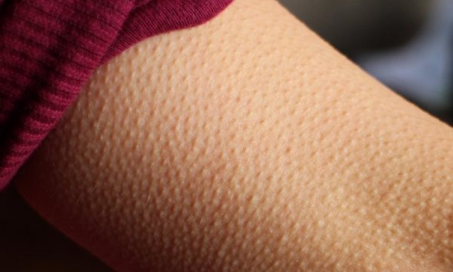 Nëse muzika ju rrëqeth, truri juaj është i veçantë