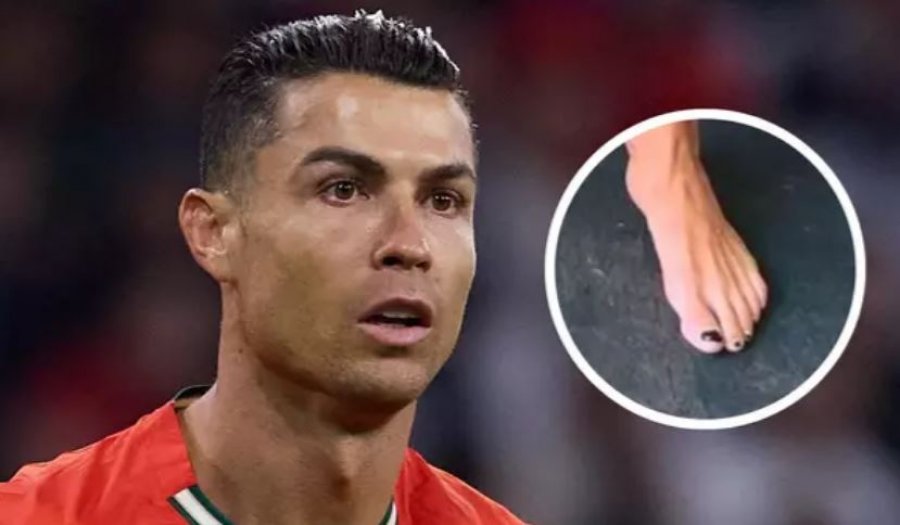 Pse Ronaldo i lyen thonjtë e gishtave të këmbës?
