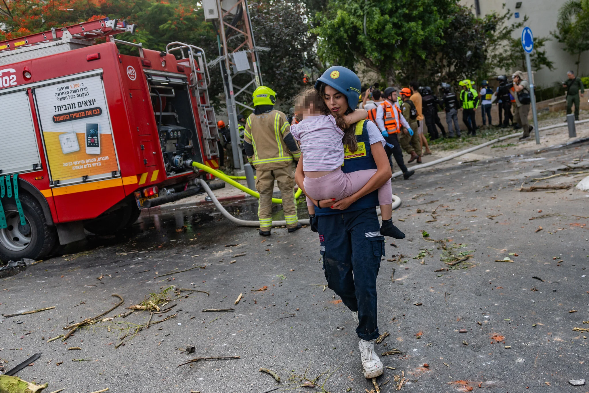 86 izraelitë të shtruar në spital pas sulmeve të reja iraniane