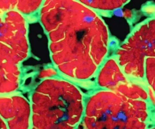 Një gjen miqësor ndaj zemrës ndihmon riparimin e saj pas një ataku