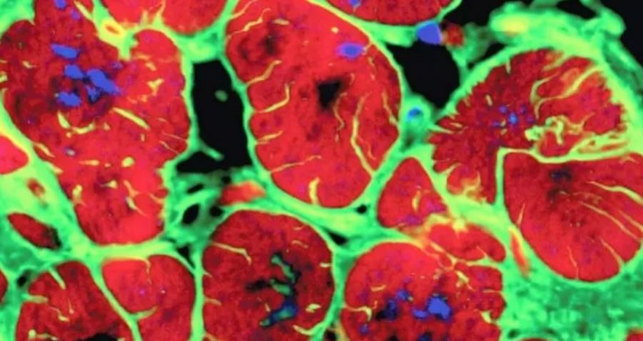 Një gjen miqësor ndaj zemrës ndihmon riparimin e saj pas një ataku