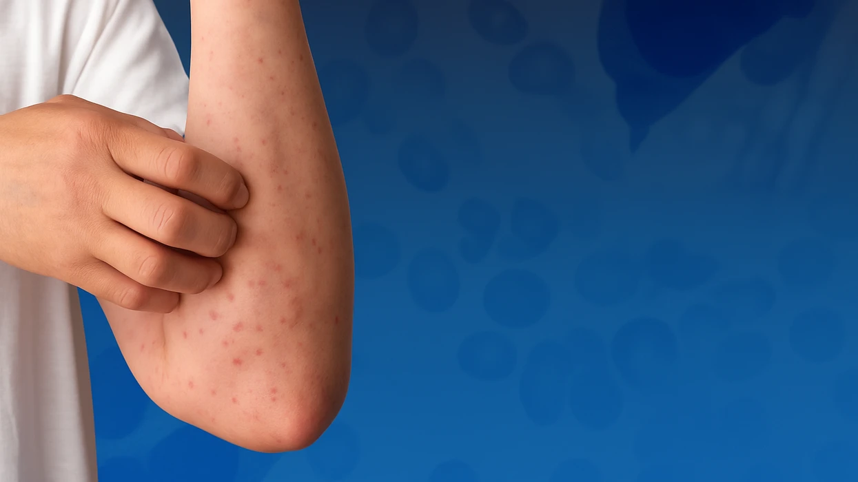 Kruarje, djersitje dhe lodhje - sëmundje e rrallë e gjakut që kërkon trajtim të hershëm dhe terapi inovative