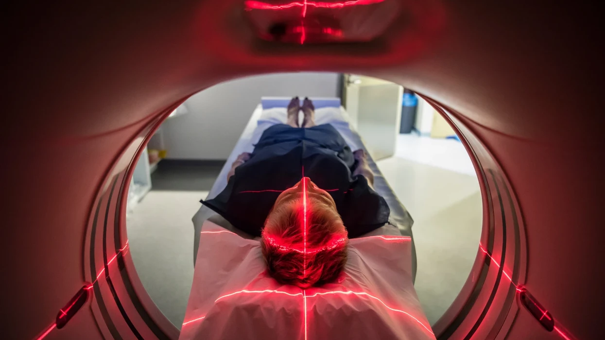 CT-ja skaneri nën lupë, sa i rrezikshëm është vërtet rrezatimi për shëndetin?