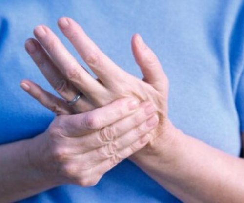 Nëse ju mpihen duart, duhet t’i drejtoheni mjekut me urgjencë 