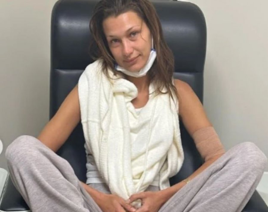 Bella Hadid ndan përvojën e saj me ankthin mjekësor gjatë betejës me sëmundjen Lyme