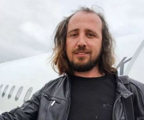 Shqiptari vdes në Turqi pasi mbolli flokët dhe rregulloi dhëmbët