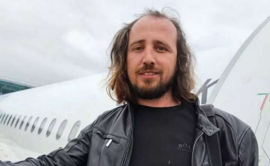 Shqiptari vdes në Turqi pasi mbolli flokët dhe rregulloi dhëmbët