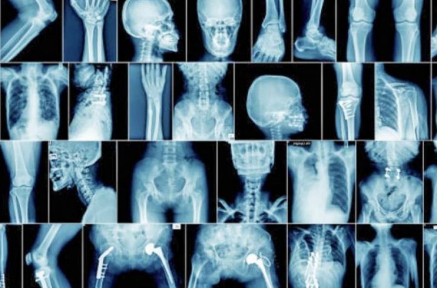 ja-si-ta-kuptoni-se-vuani-nga-artriti