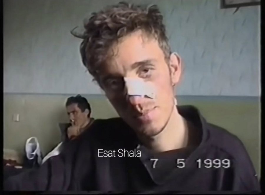 Si u fsheh Behar Topilla pas trupave për të mbijetuar?