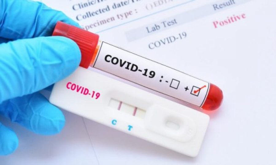Rriten rastet me COVID-19 në Shqipëri