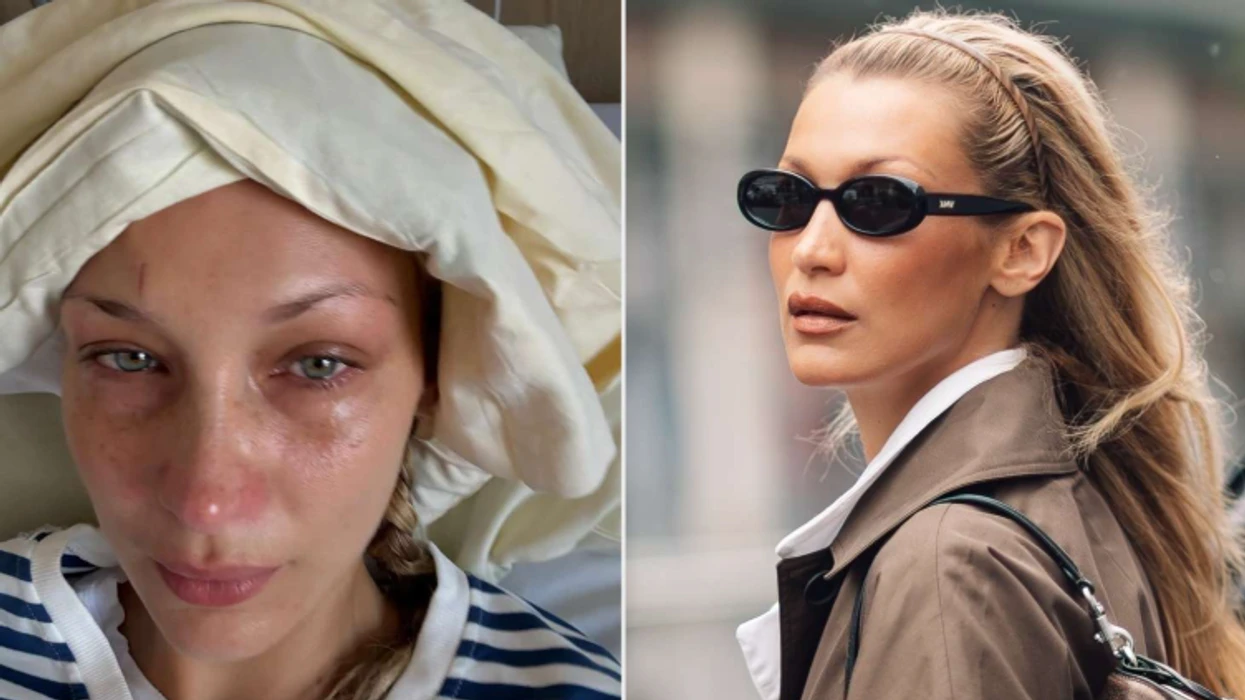 Bella Hadid flet hapur për betejën e gjatë me depresionin  E nisja çdo ditë me lot