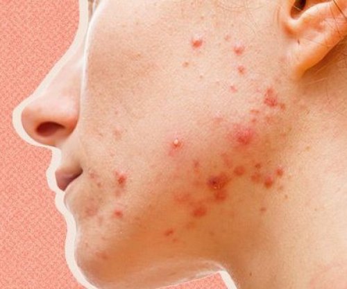 Si e kontrollojnë hormonet jetën tonë?