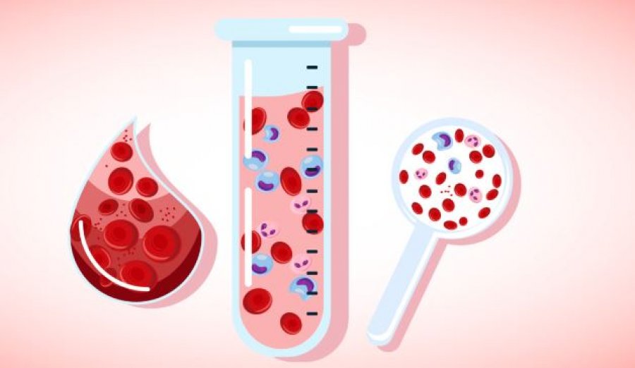 Anemia rrezik i fshehtë për shëndetin, simptomat që nuk duhet t’i injoroni