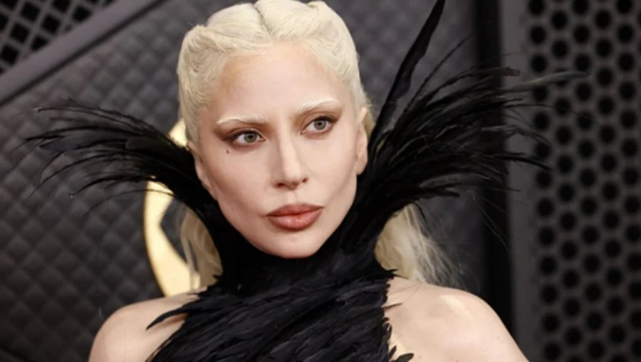 Lady Gaga anulon performancën e fundit në turne  Po luftoj me një infeksion respirator  më vjen keq 