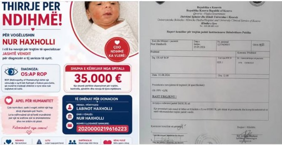 Familja Haxholli kërkon ndihmë për trajtimin e vogëlushit Nur  nevojiten 35 mijë euro