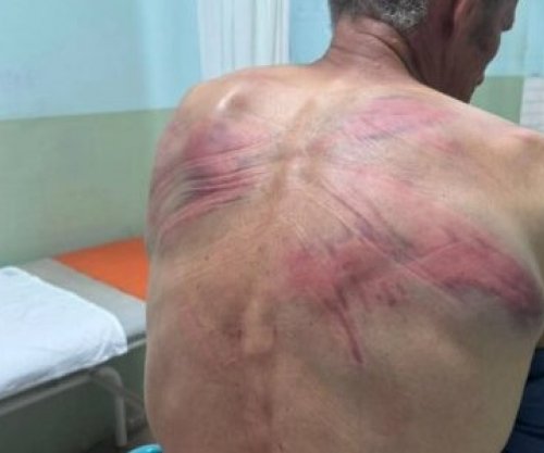 IPK-ja nis hetimet, pas pretendimeve të një serbi se u rrah nga policia në Zubin Potok