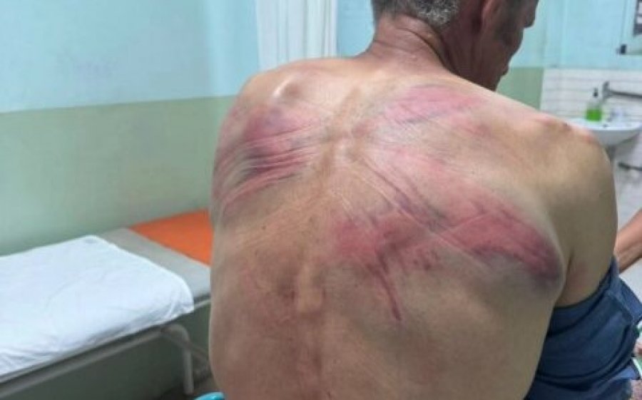 IPK ja nis hetimet  pas pretendimeve të një serbi se u rrah nga policia në Zubin Potok